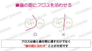 フロスの使い方　歯の面に沿わせて使う